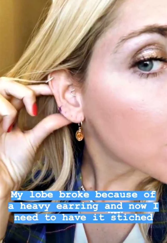 Chiara Ferragni, lobo dell'orecchio lacerato: ecco come si è sfregiata