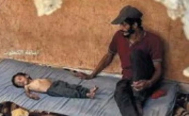 Gaza, le foto dei finti denutriti smascherate dalla stampa Usa