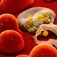 Aids, un vaccino riduce