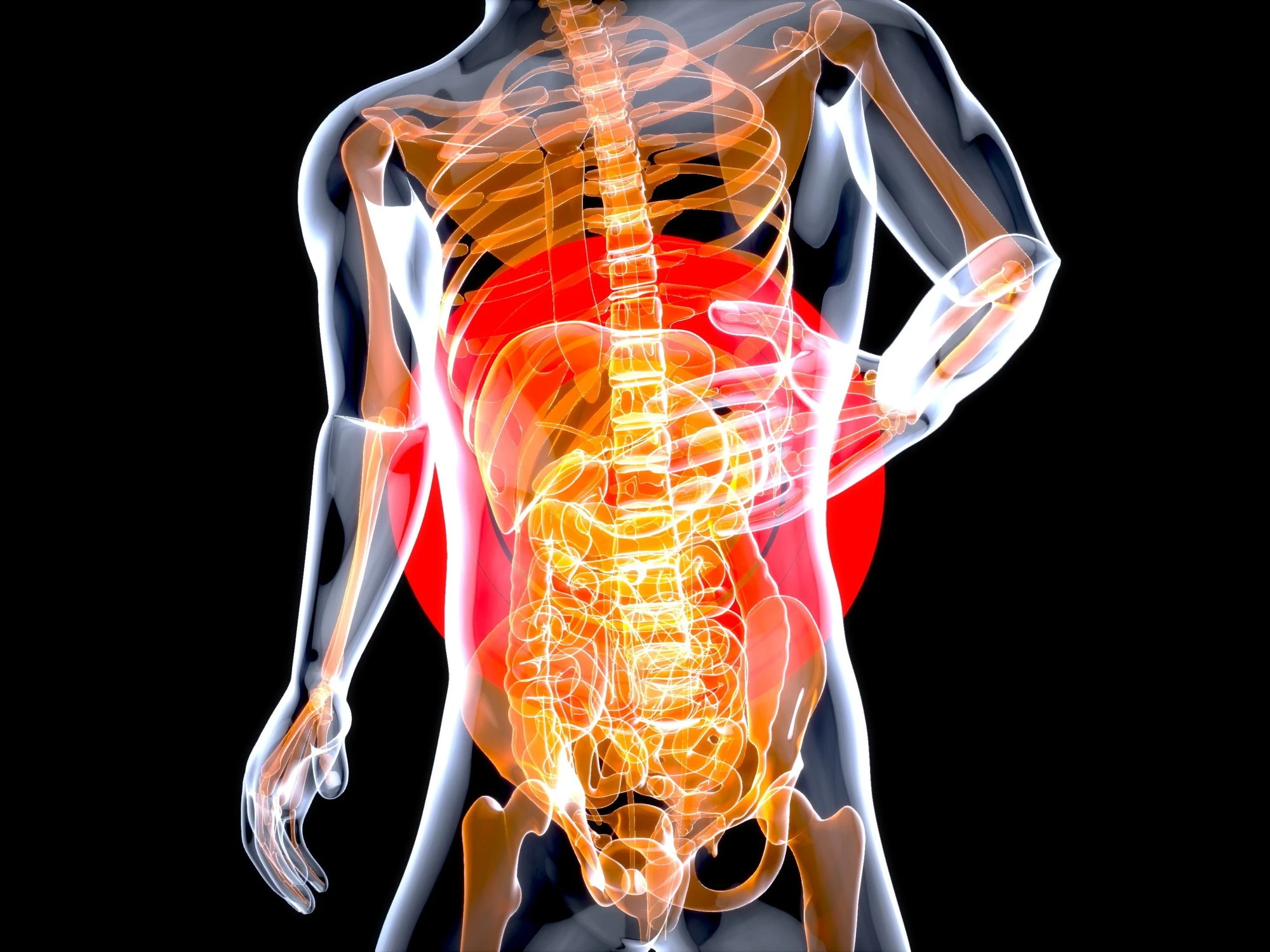 Sclerosi multipla, i 2 batteri intestinali che innescano la malattia
