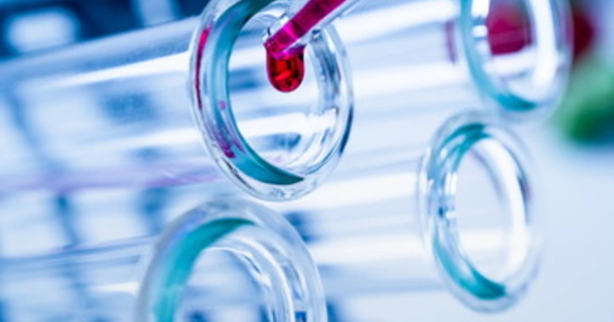 Coronavirus, accordo tra aziende Usa-Svizzera per la produzione di 1 miliardo di dosi di vaccino sperimentale all'anno