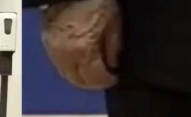 Putin, mano destra gonfia e con vene in vista: "Qualcosa non va"