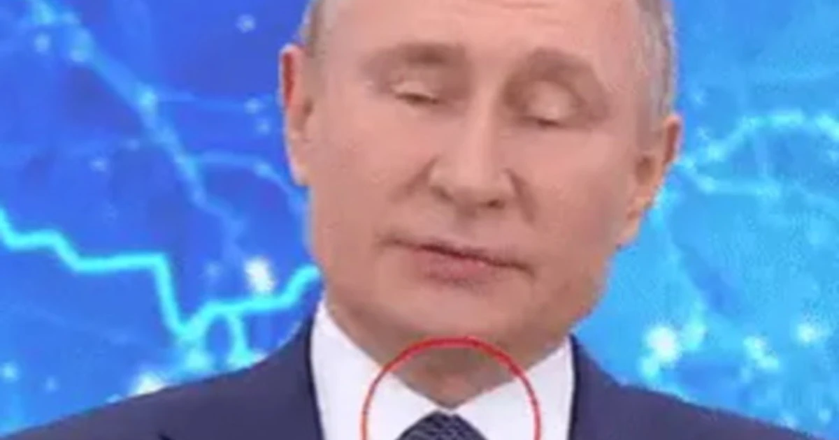 Vladimir Putin, "la cicatrice sul collo": il video-choc, cosa svela