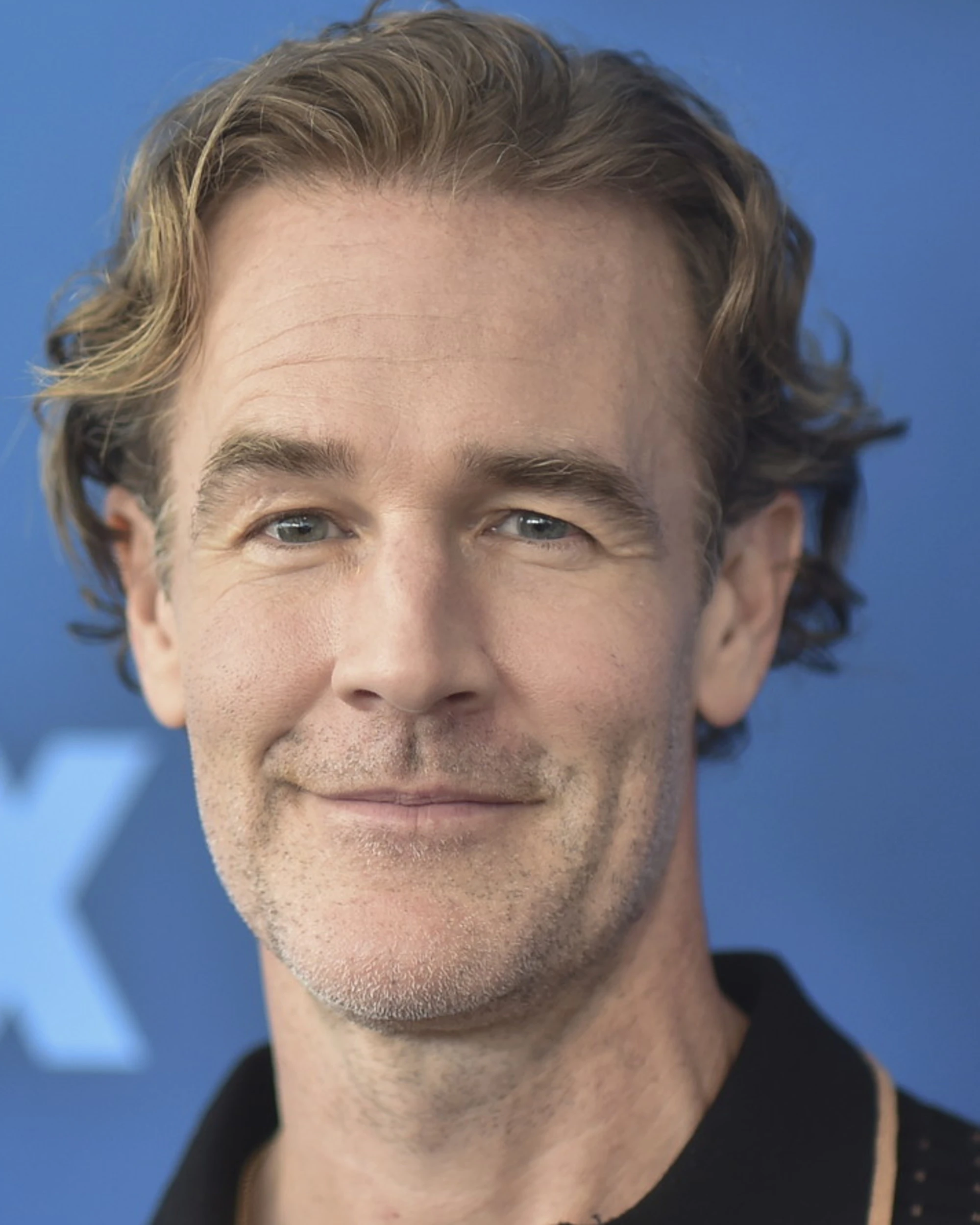 Dawson's Creek, il dramma della star della tv: "Cancro, un lavoro a tempo pieno"