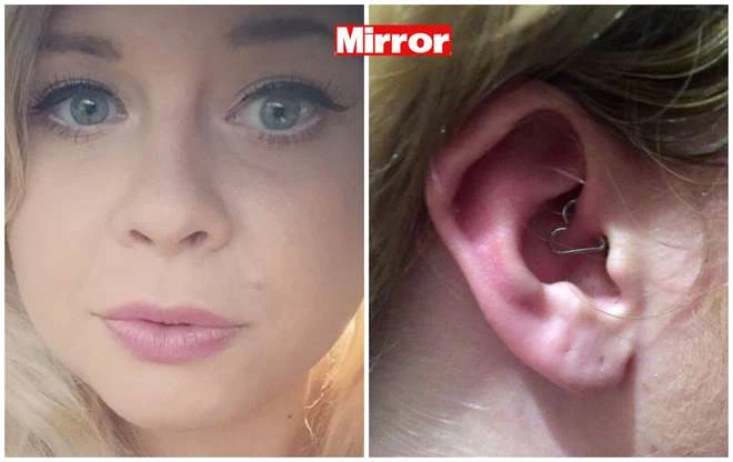 Samantha ha sconfitto l&apos;emicrania con un piercing all&apos;orecchio: soffriva da 21 anni
