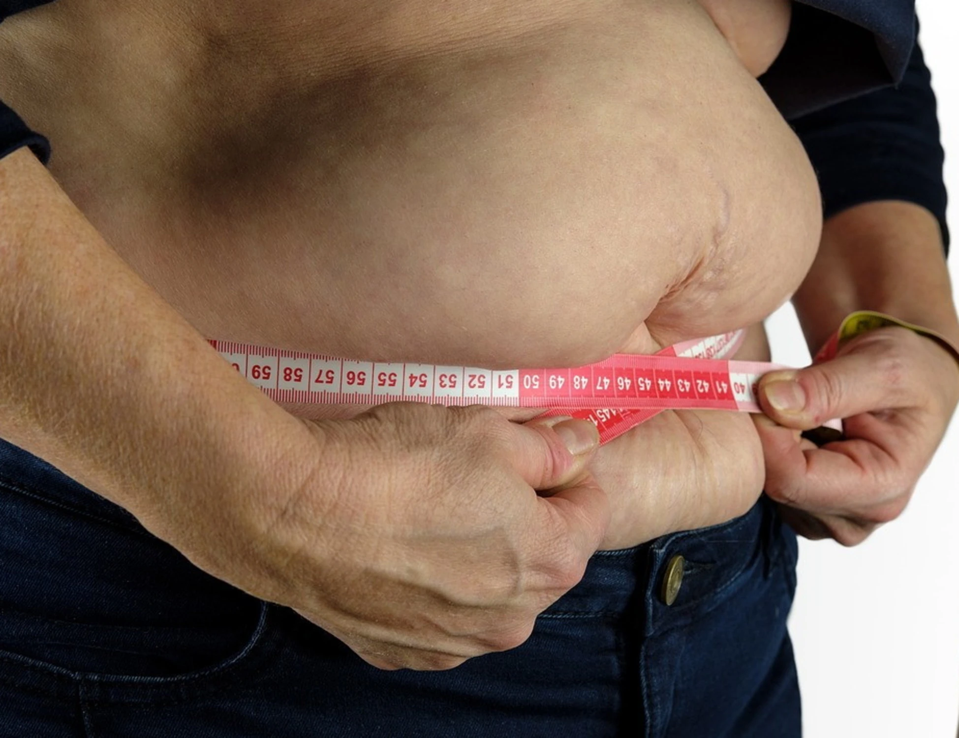 Obesità, il nuovo farmaco: chi può usarlo