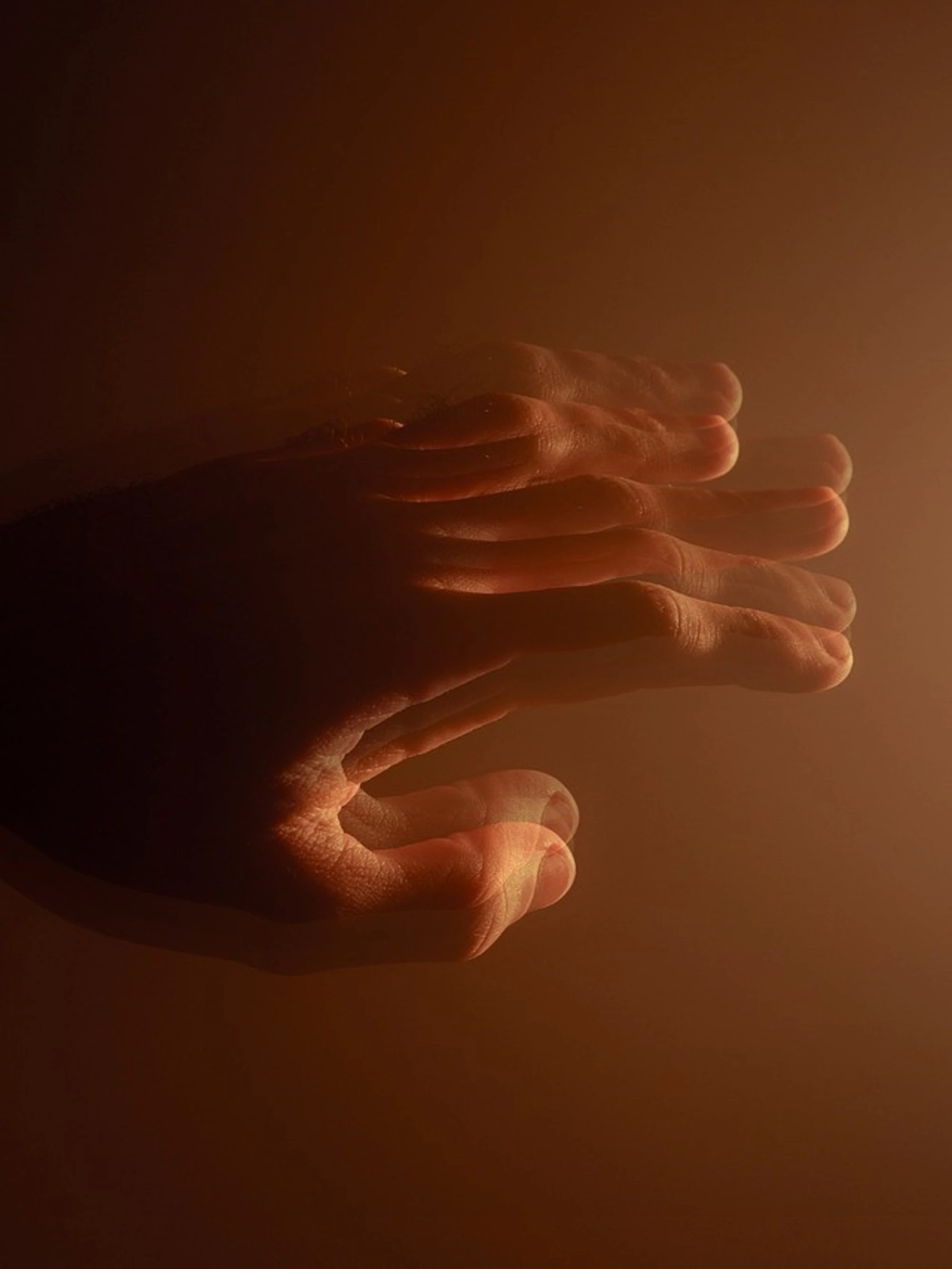 Parkinson, il (drammatico) sintomo sottovalutato