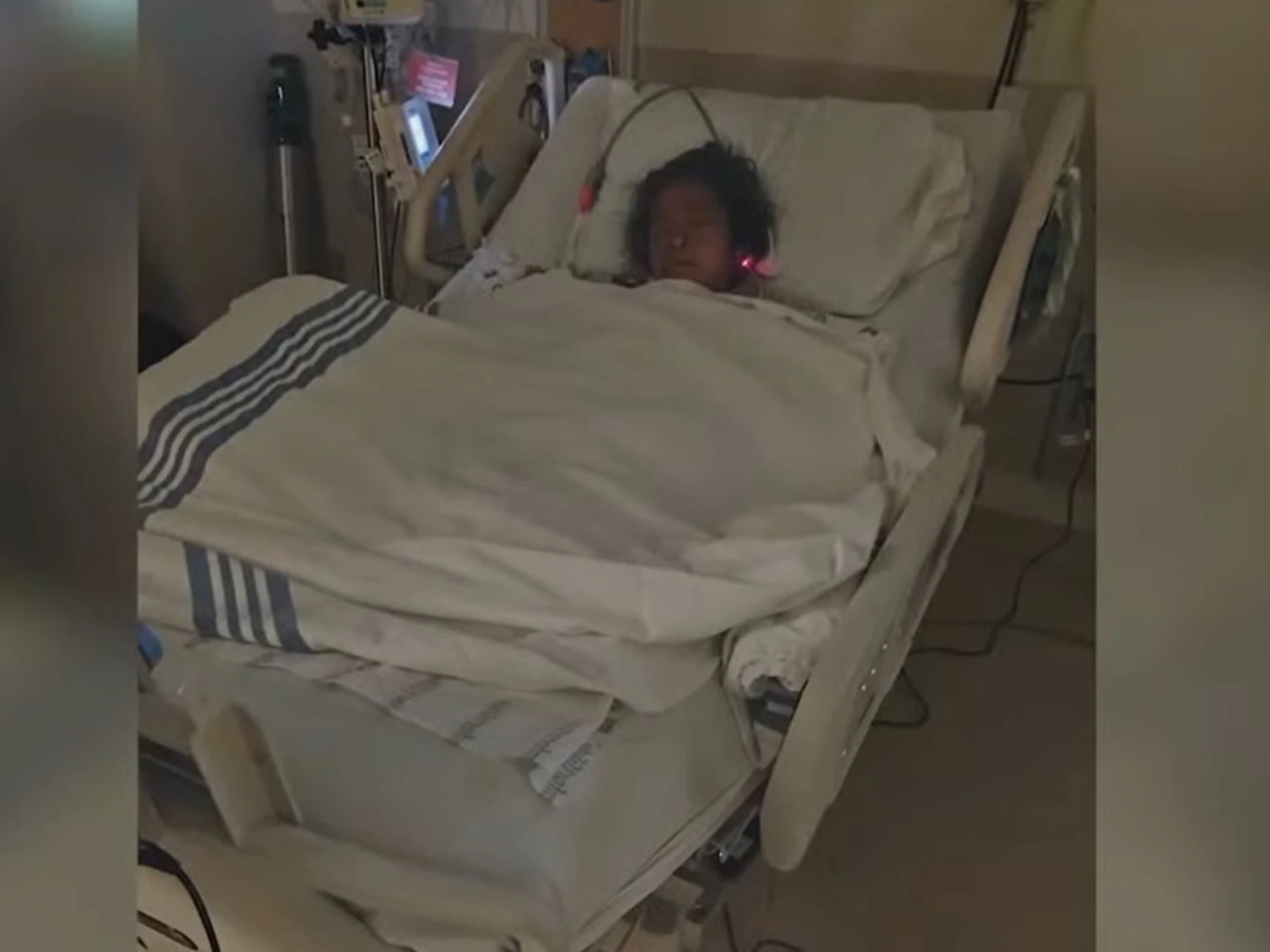 Sbranata da due pitbull, amputati tutti gli arti: orrore senza precedenti