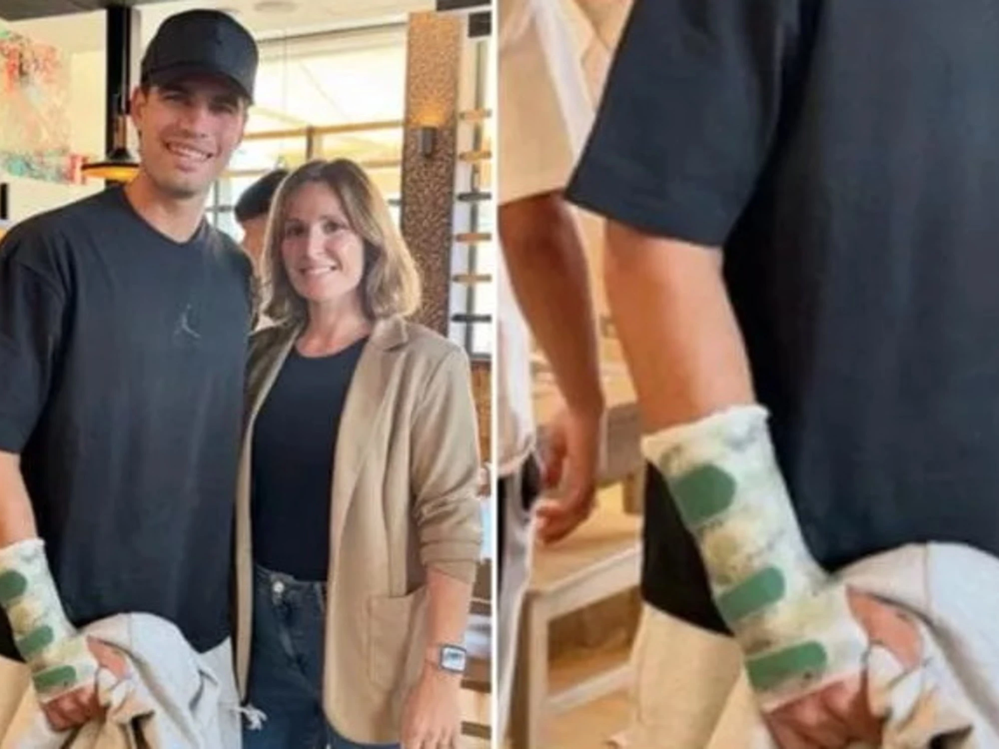 Carlos Alcaraz, il dramma: la foto col tutore (e addio Roland Garros?)