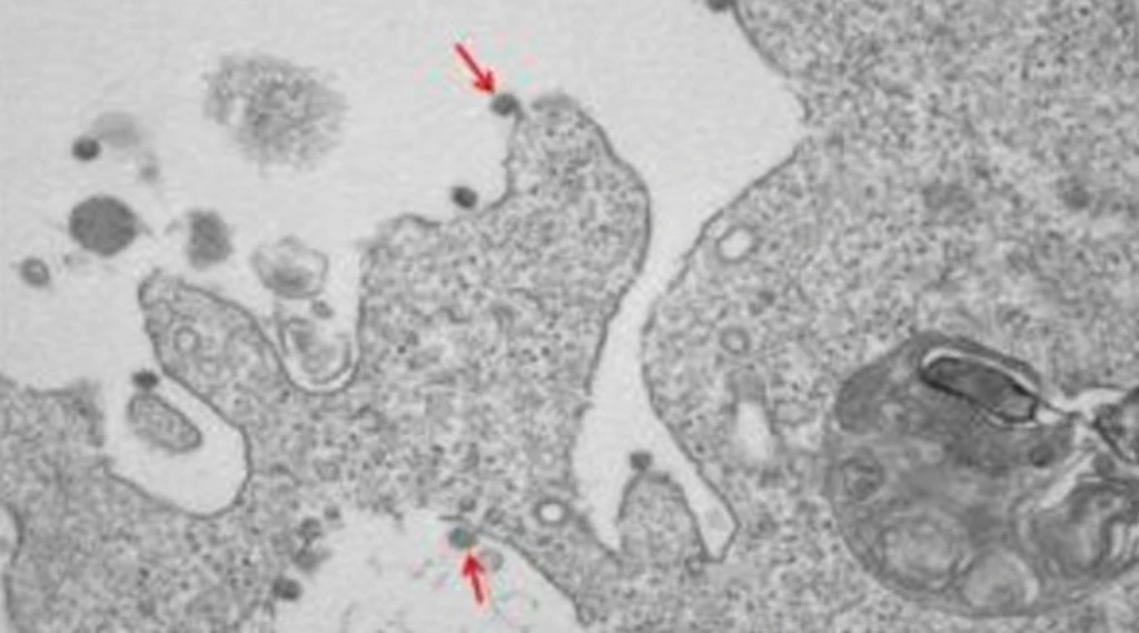 Coronavirus, dall'ospedale Sacco di Milano le foto del Covid lombardo che sta facendo una strage