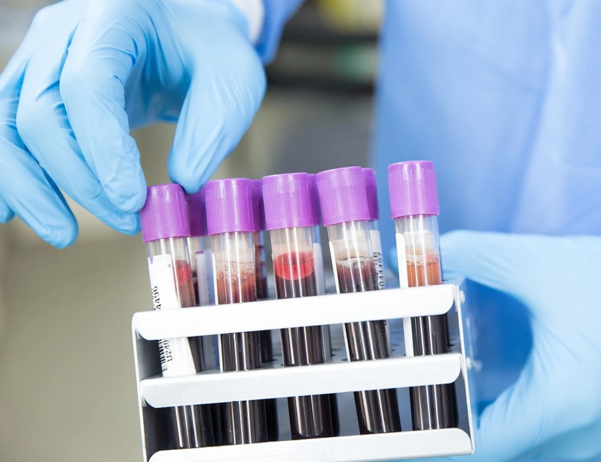 Longevità, così due spie nel sangue rivelano quando morirai