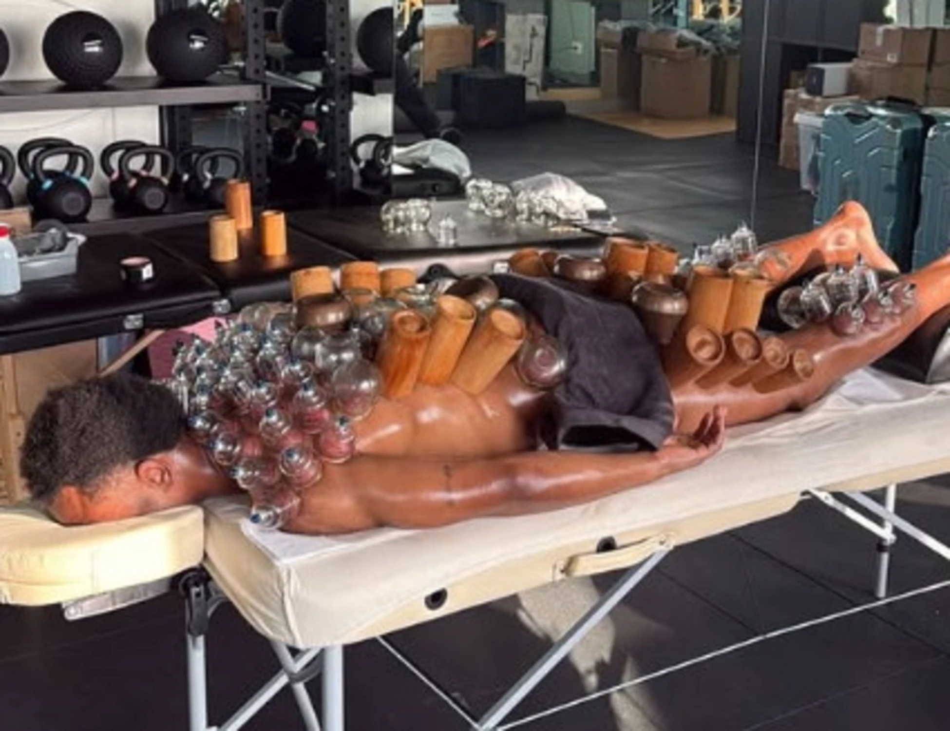 Lois Openda e il "cupping": Juve, tentativo disperato per farlo risorgere