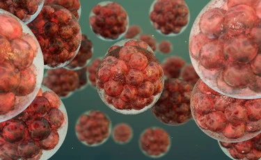 Tumore al pancreas, una possibile cura nella combinazione di 3 farmaci 