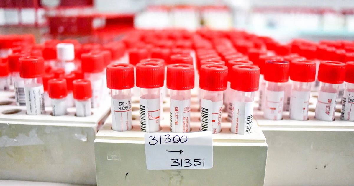 Coronavirus, dalla Federico II la possibile nuova terapia: svolta legata alla interluchina