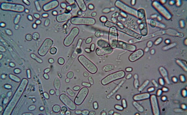 Caldo anomalo, spopola il vibrio: il batterio infetta i nostri mari, i sintomi e i gravi rischi