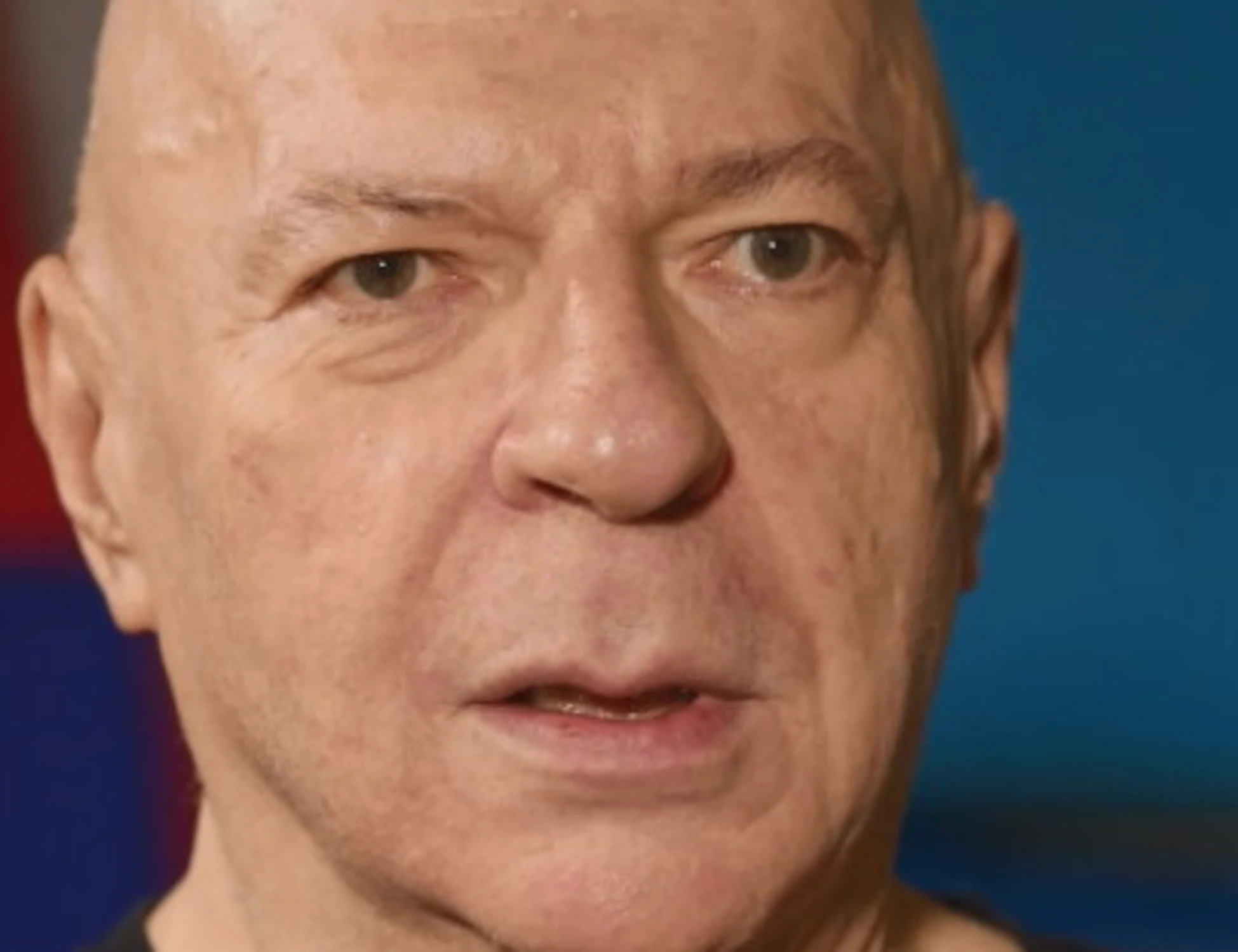 Platinette, "non ho più il controllo di me stesso": due ictus, come sta ora