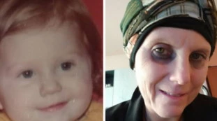 Milano, la 48enne ha un tumore e chiede aiuto alla mamma biologica. Basta un esame de sangue ma lei rifiuta