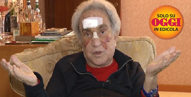 Emilio Fede sfigurato, l'impressionante fotografia dopo la caduta nel suo condominio