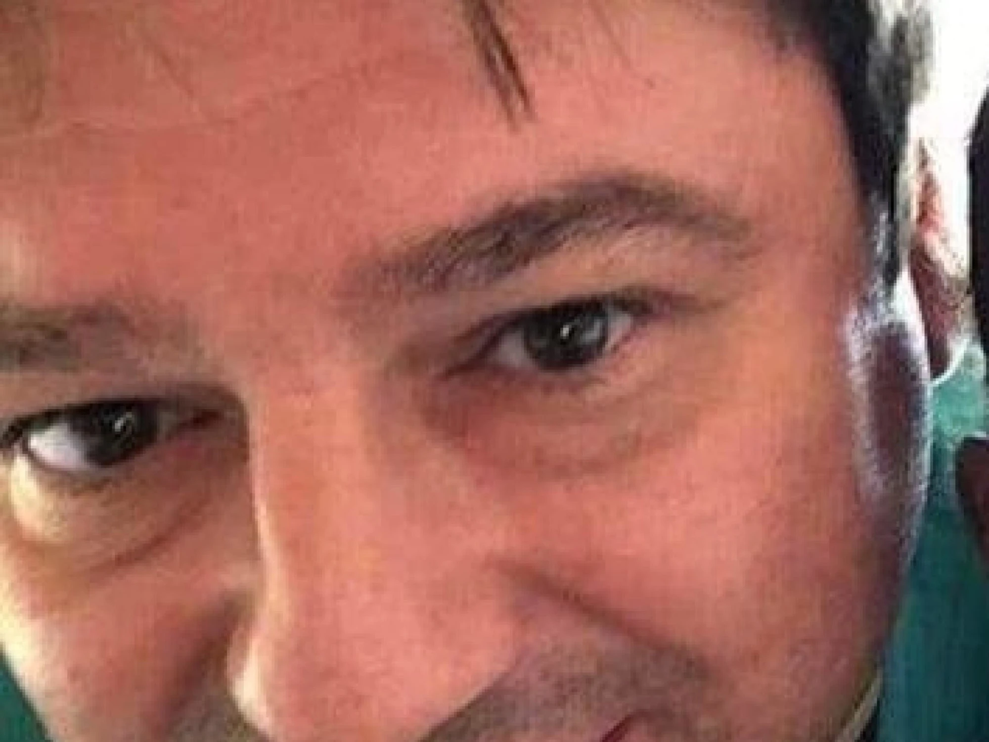 Domenico Caliendo, l'intercettazione-choc del chirurgo: "Il cuore l'ho tolto, diciamo..."