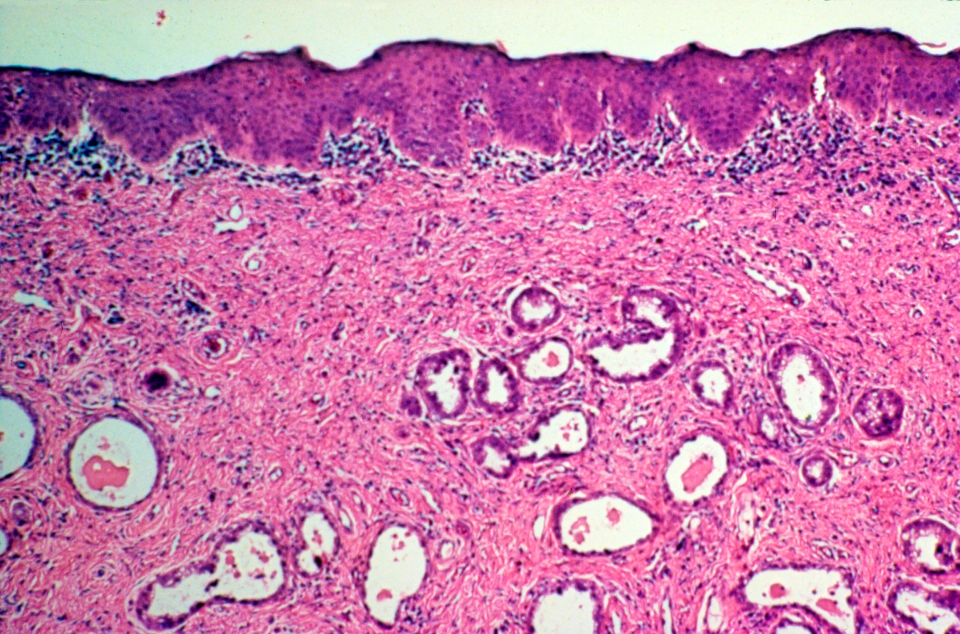 Tumori, scoperta la molecola che blocca la crescita: su quali può intervenire, svolta rivoluzionaria
