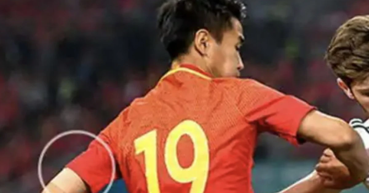 Cina, l'ultima follia comunista: occhio al braccio di questo giocatore, come lo ha ridotto il regime