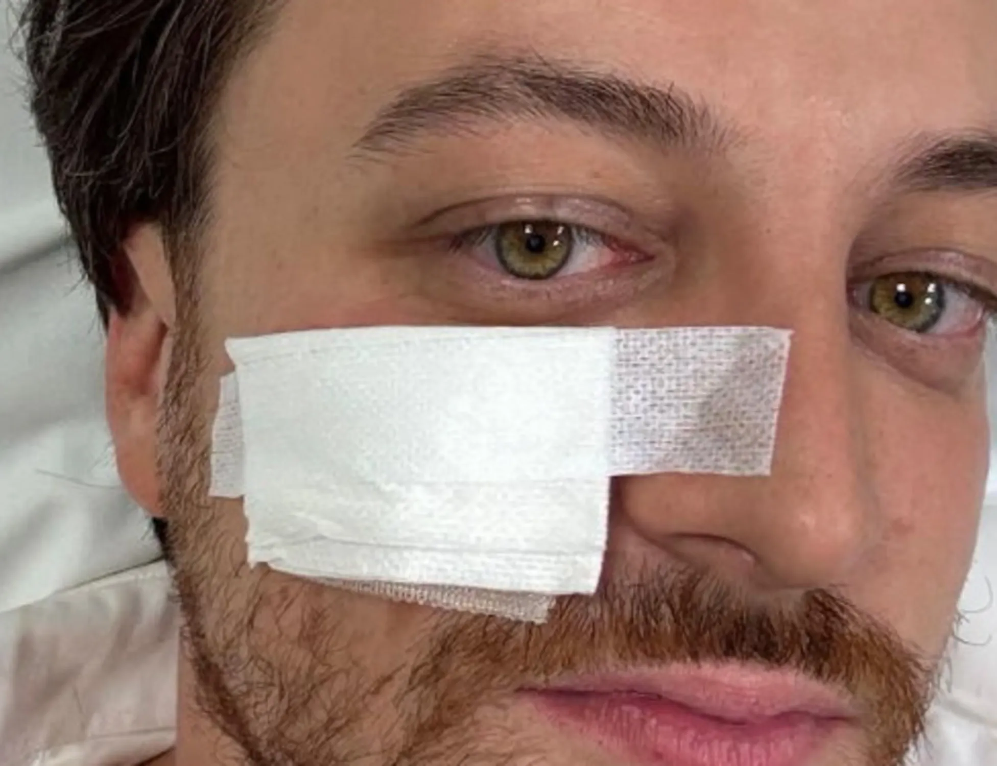 Leggi l'articolo: Alberto Stefani, incidente stradale mentre andava al consiglio federale della Lega