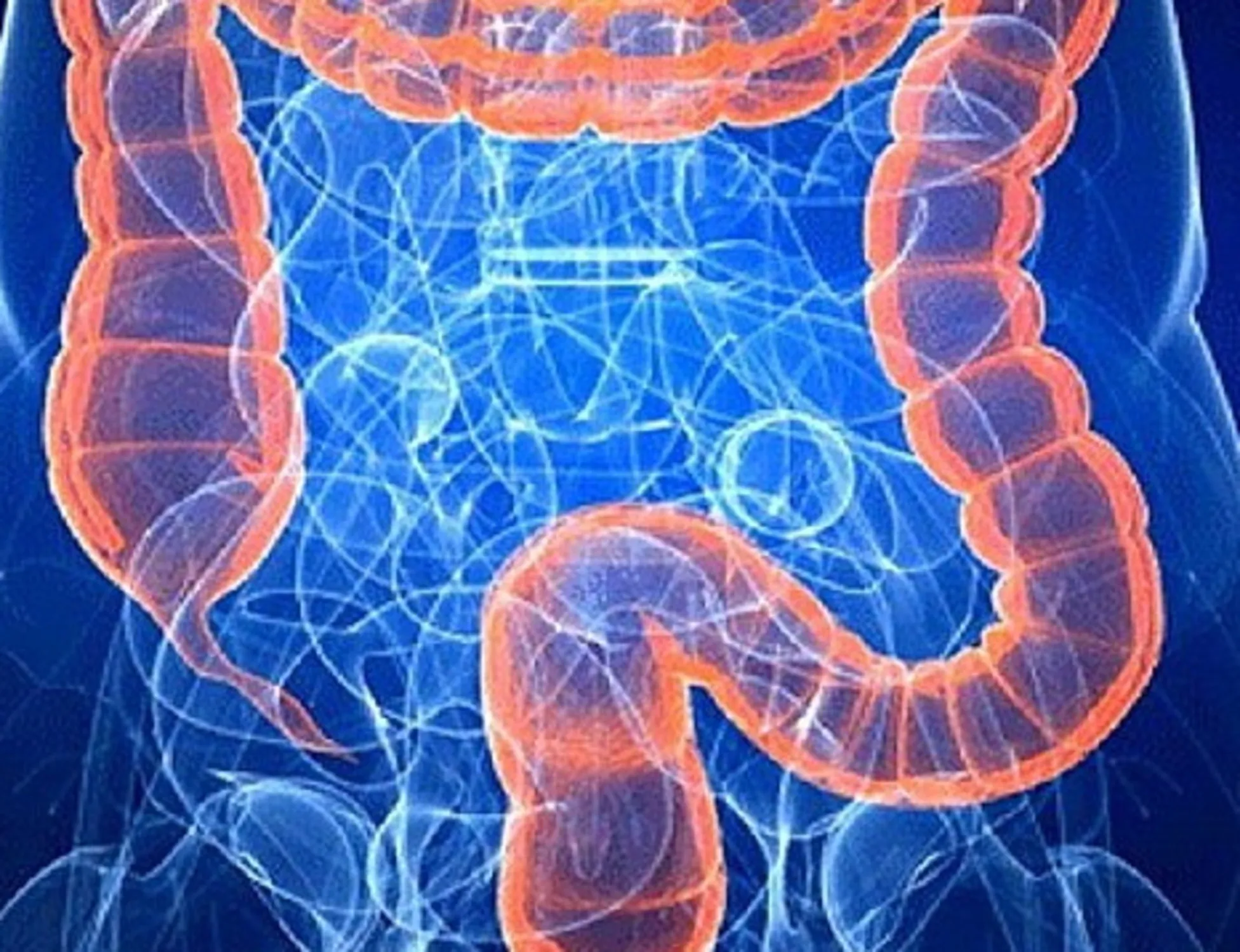 Leggi l'articolo: Tumore al colon-retto, cosa mangiare per ridurre il rischio