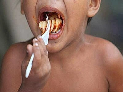 Sono più di ottocento milioni le persone che soffrono la fame ogni giorno