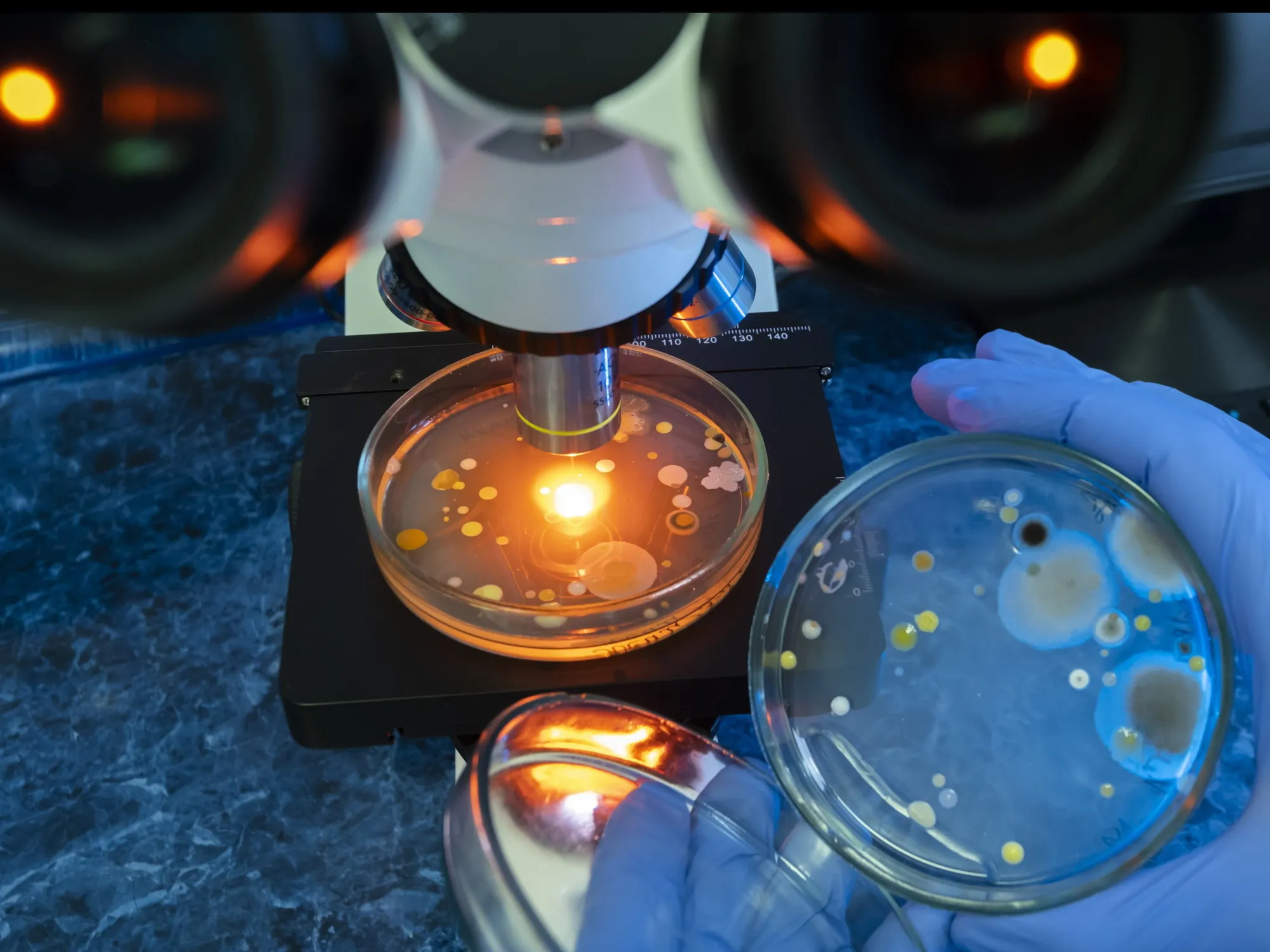 Tumore al testicolo, la nuova cura: come cambia la battaglia