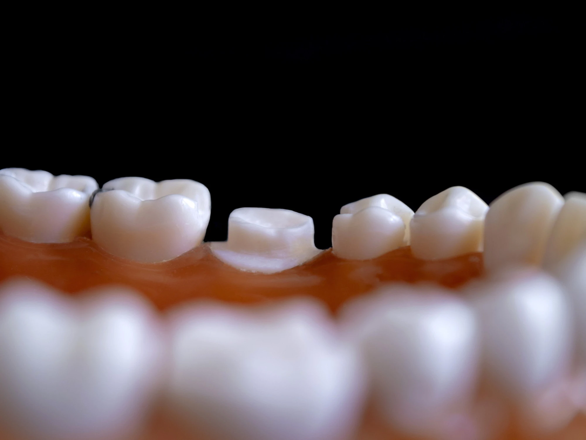 Genova, somalo morde il dentista e sputa ovunque: studio chiuso