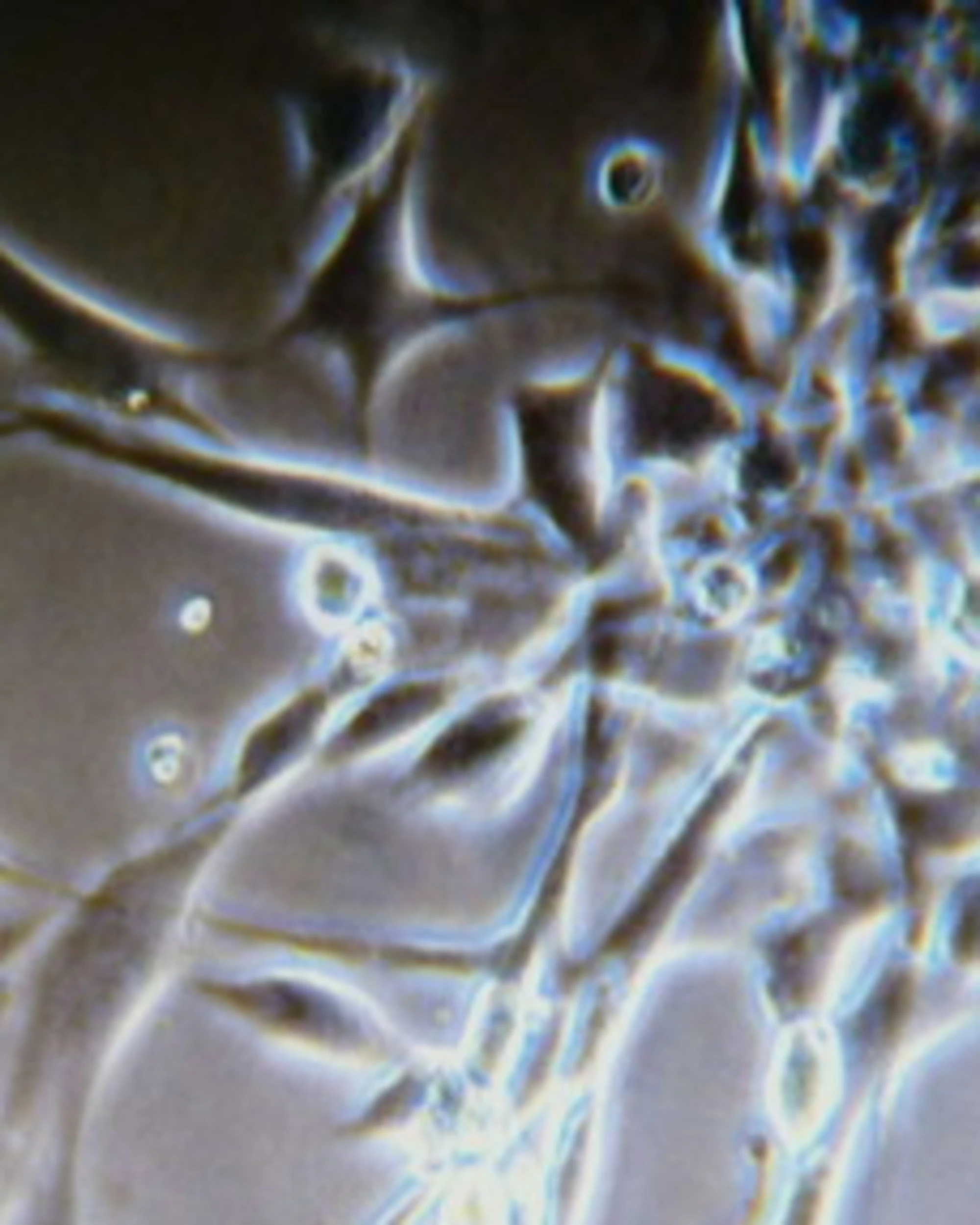 Cancro, come ha trasmesso il tumore a 18 figli