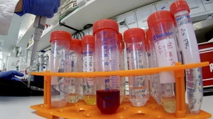 Coronavirus, lo studio su Wuhan: "Un infetto può contagiare anche 37 giorni dopo", cambio di paradigma?