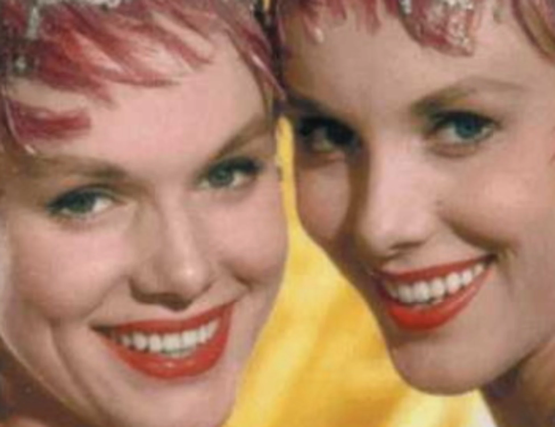 Gemelle Kessler, una vita in simbiosi e l'ultima drastica volontà