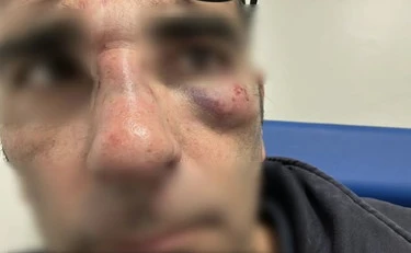 https://media.liberoquotidiano.it/FEMTx-VR4dO2gJRviTFBCSDXXs19TlUySUTQMozKJo0/width:800/quality:90/aW1hZ2VzLzIwMjUvMTAvMTQvMTQxODMwNjgxLTZjN2RkM2Y4LWE1NTUtNGRkZS04OGQyLWU1MjhmMDQxZTc1Yi5qcGc.webp
