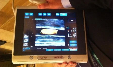 Smartphone e tablet per fare le ecografie