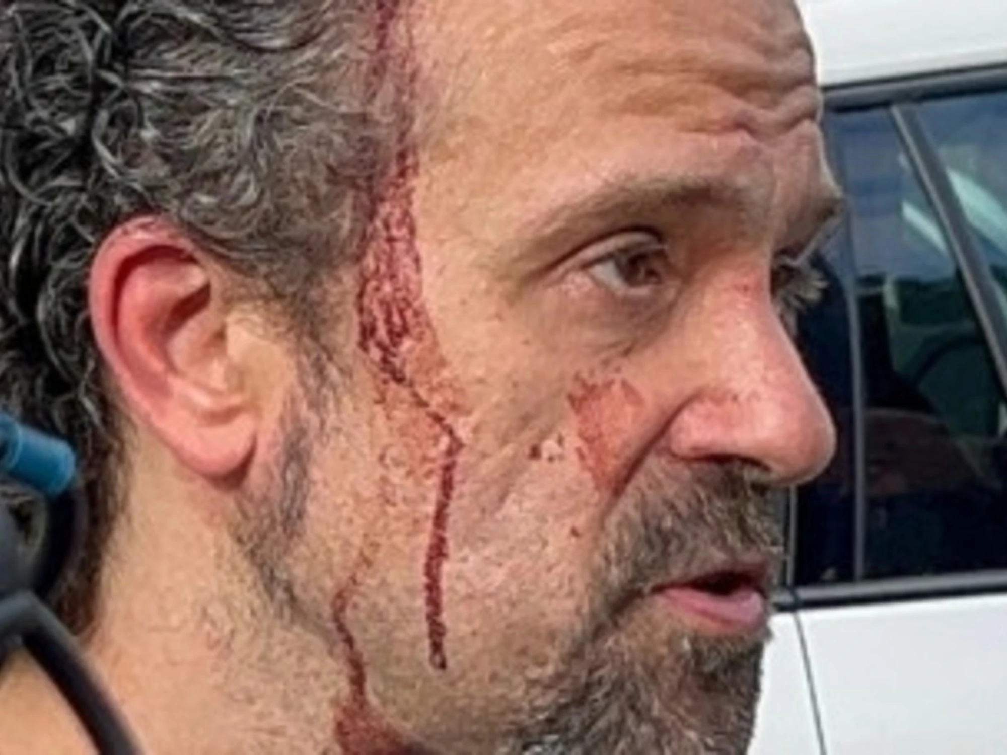 Modena, parla l'uomo che ha fermato il 31enne: "Blaterava qualcosa, poi mi ha accoltellato"