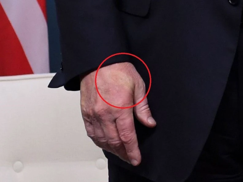Stretta di mano troppo vigorosa, Macron lascia il segno su quella di Trump