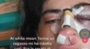 Torino, Irene pestata in discoteca: "Mi hanno dato un pugno senza motivo"