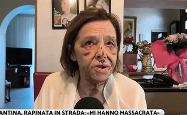 Bergamo, Santina a 80 anni massacrata in strada: chi l'ha ridotta così