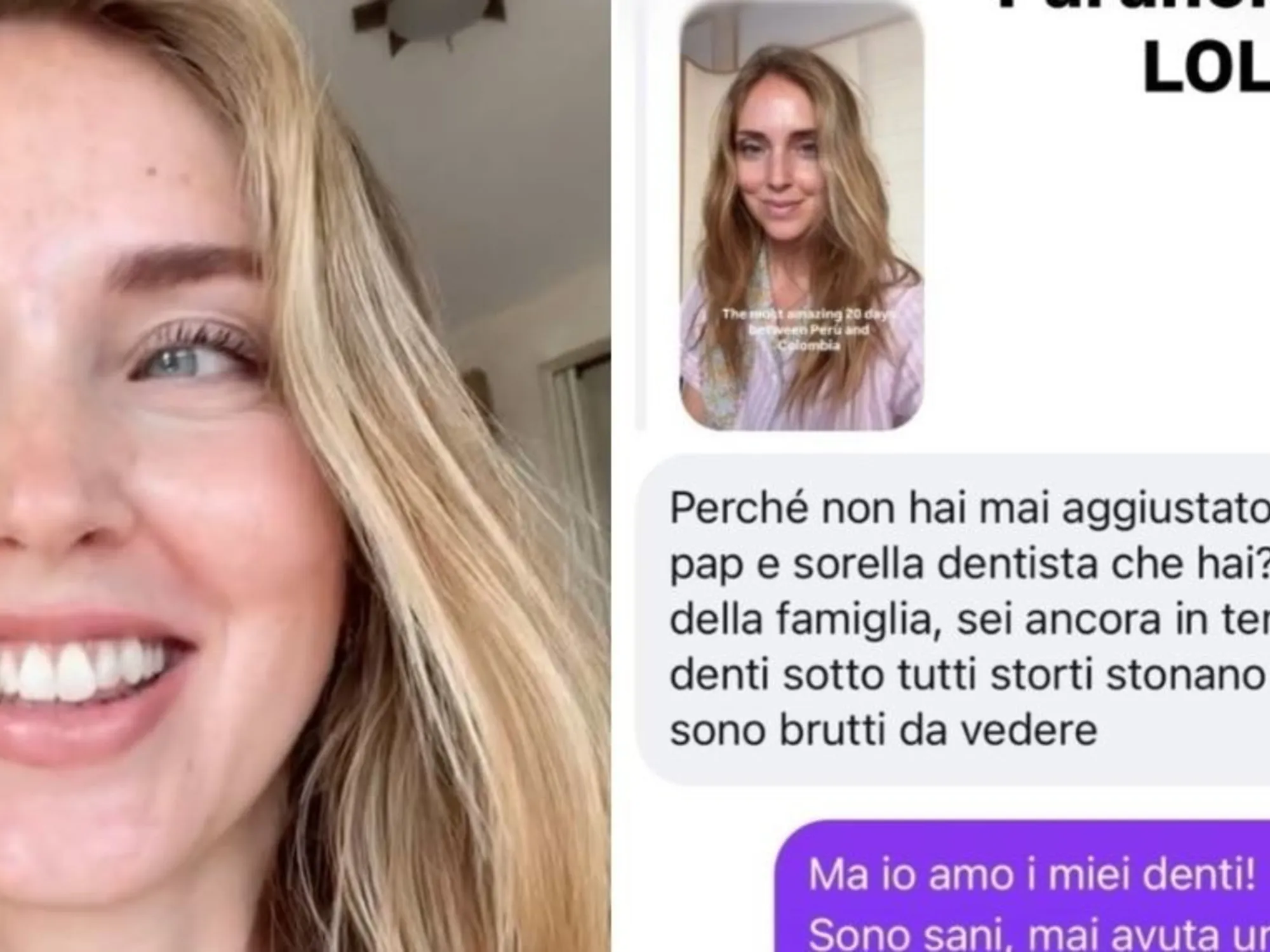 Leggi l'articolo: "Hai i denti tutti storti e brutti da vedere": la risposta di Chiara Ferragni lascia senza parole