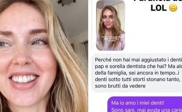 Chiara Ferragni, "hai i denti tutti storti e sono brutti da vedere": la risposta gela tutti