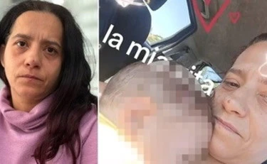 Bimbo col cuore bruciato, "10% di possibilità per il nuovo trapianto"