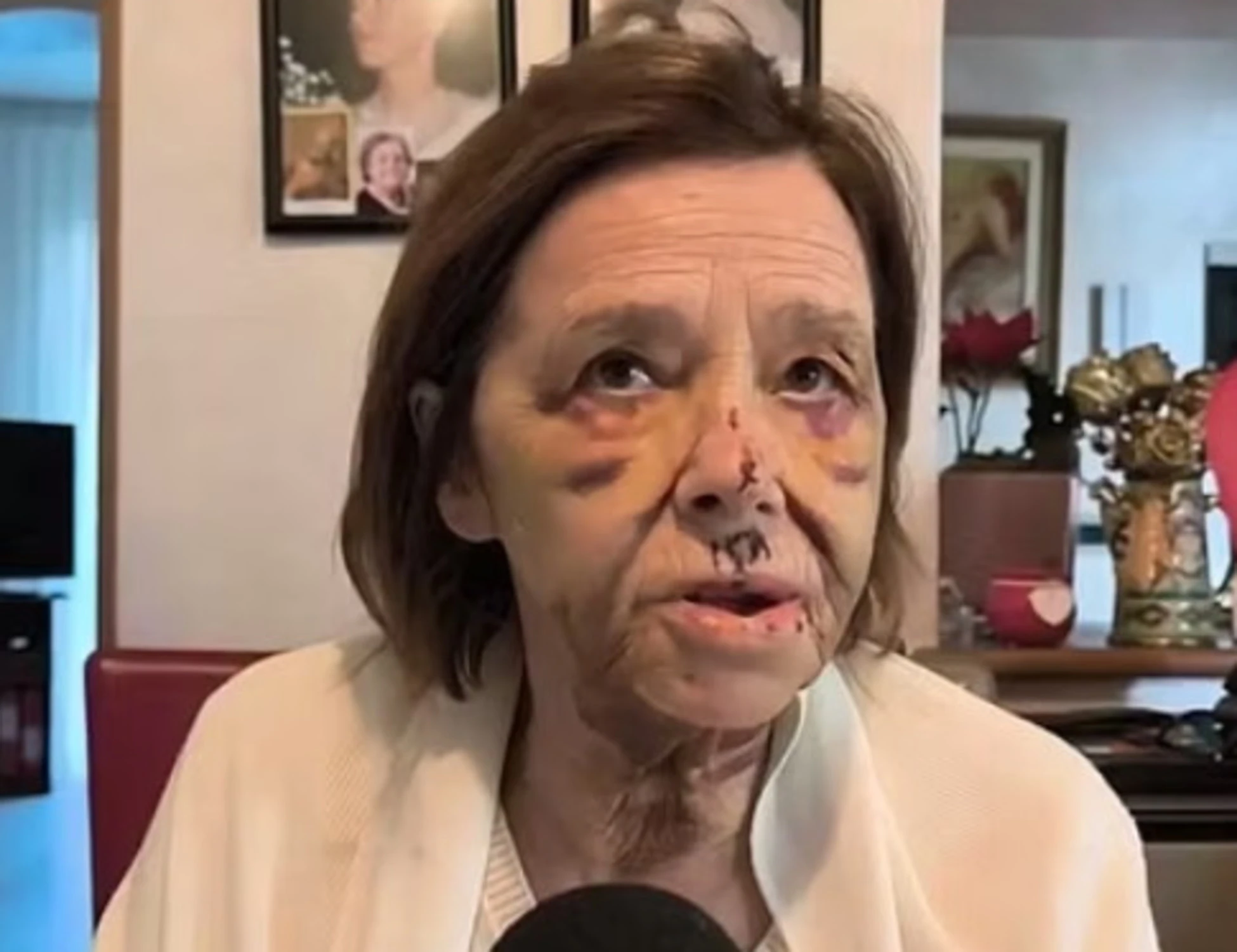 Bergamo, Santina a 80 anni massacrata in strada: chi l'ha ridotta così