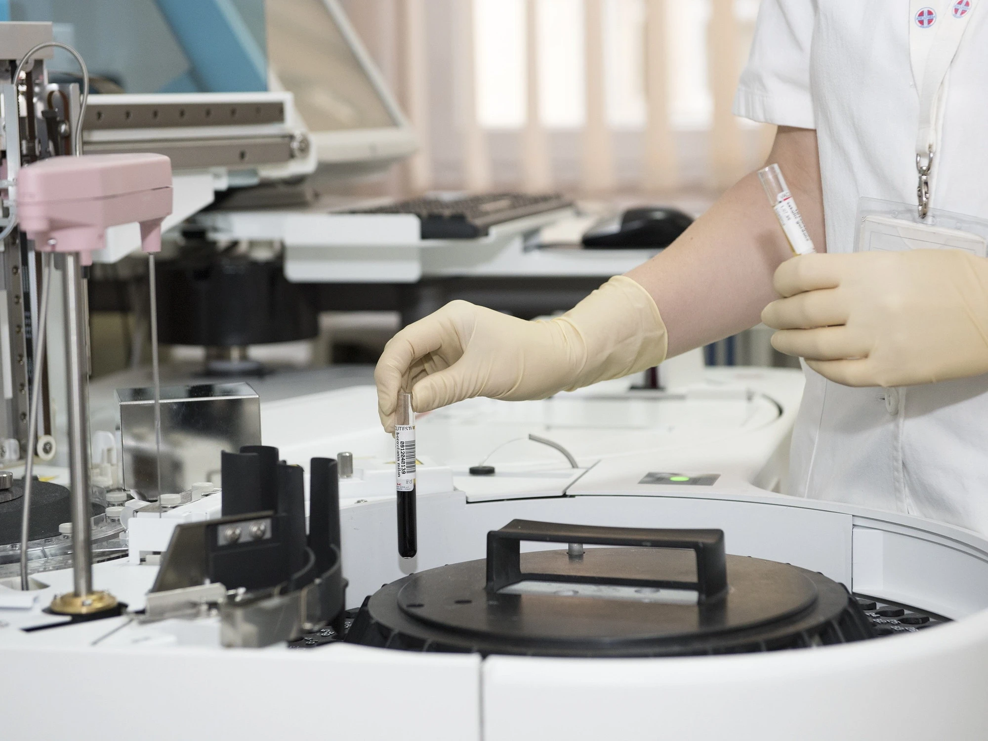 Come il plasma freddo riprogramma le difese autoimmuni 