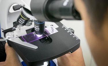 Muscoli, il meccanismo dietro al loro invecchiamento