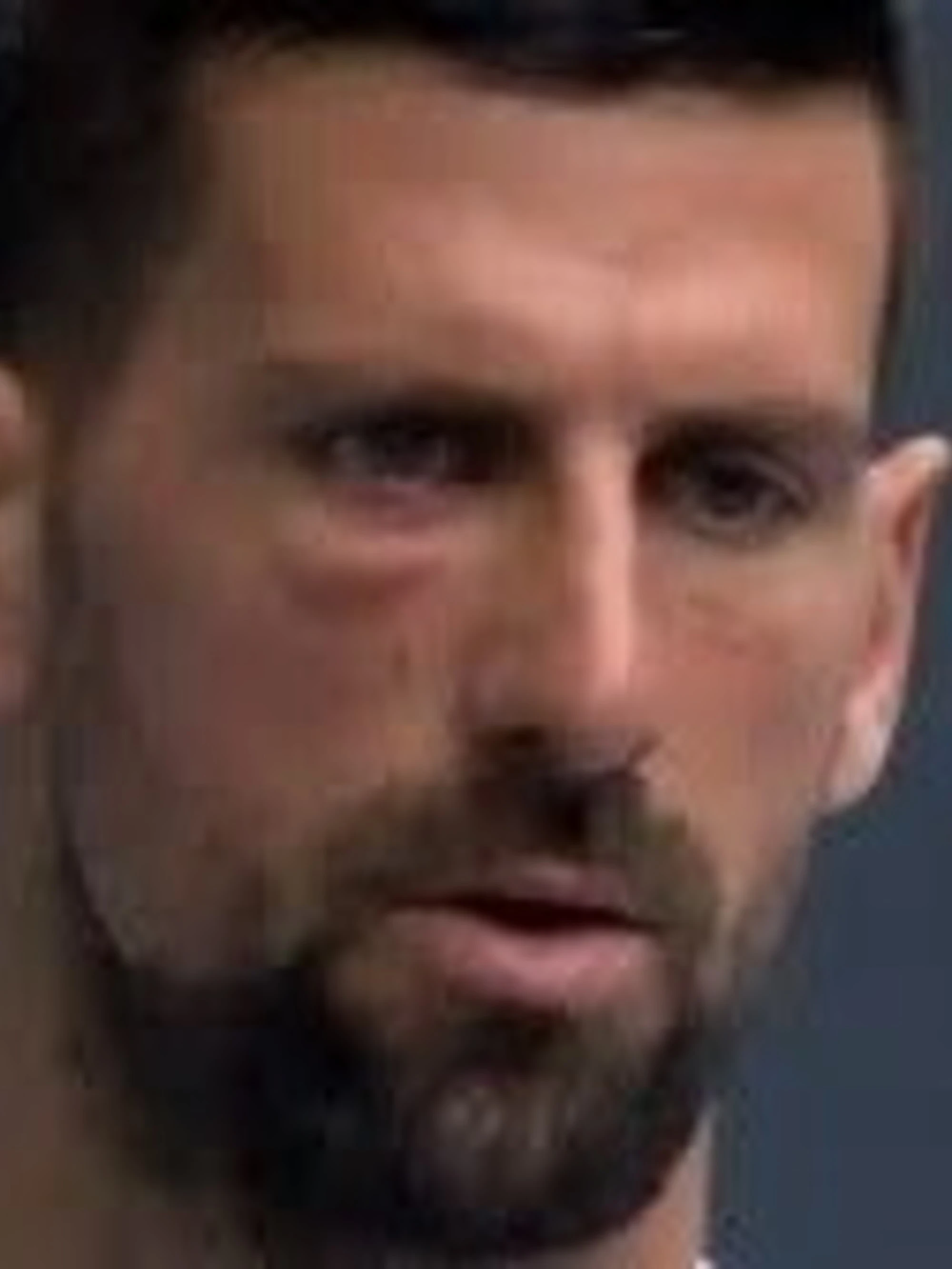 Novak Djokovic con l'occhio gonfio: "Preferisco non commentare"