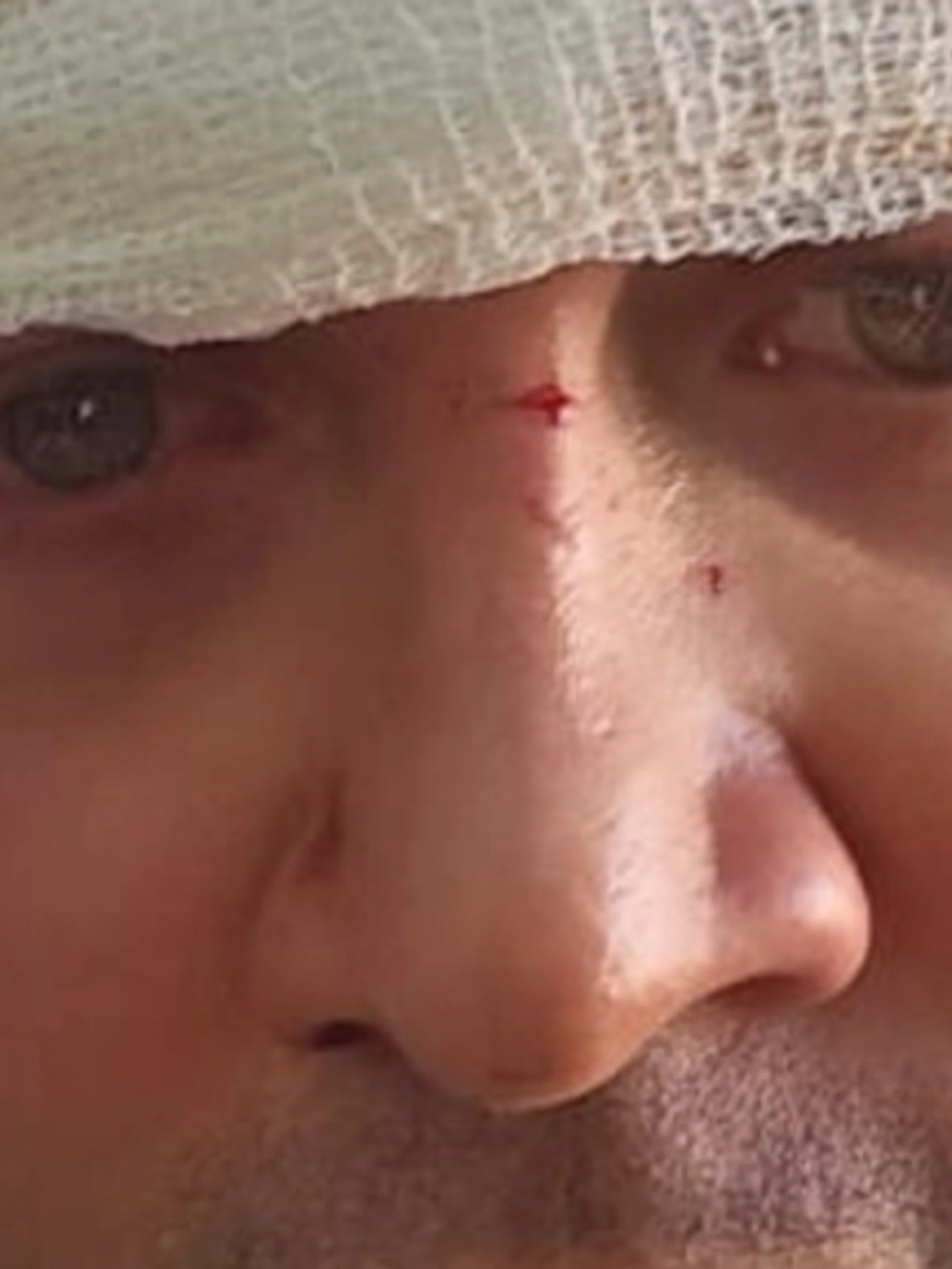 Firenze, capogruppo della Lega aggredito da un immigrato: pugni e insulti