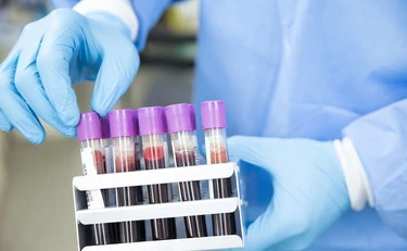 Longevità, così due spie nel sangue rivelano quando morirai