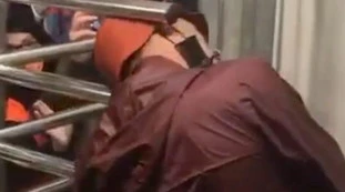 Roma-Milan, tifoso con la testa incastrata nel tornello: un orrore, com'è ridotto il poveraccio. Immagini forti