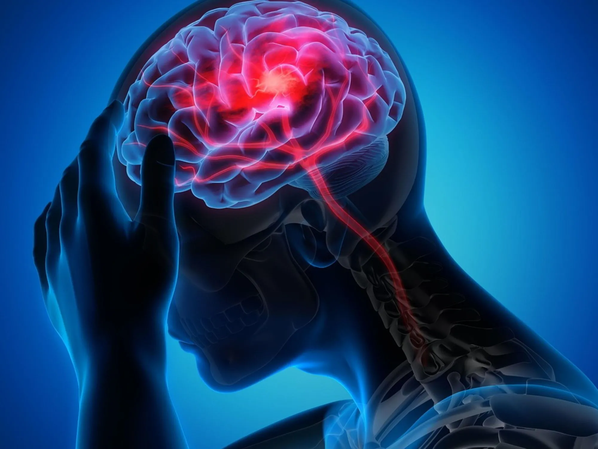 Leggi l'articolo: Emicrania aurea, ecco cosa scatena il mal di testa